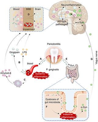 Porphyromonas gingivalis: A key role in Parkinson's disease with cognitive impairment?